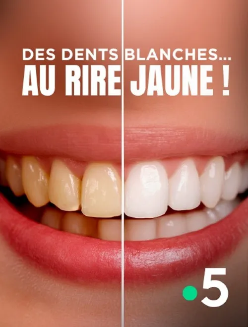 Des dents blanches au rire jaune