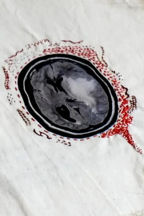 Poster for Epicrisis