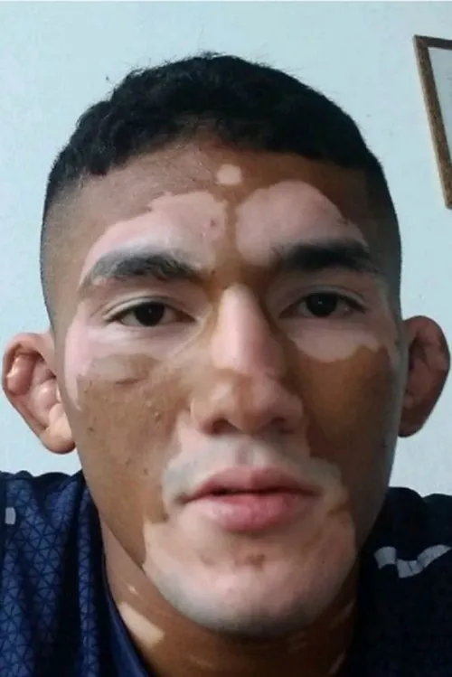 Photo of Melquizael Costa