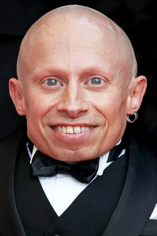 Profile photo of Verne Troyer